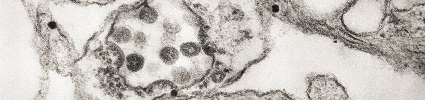 Human Coronavirus (CDC/ Dr. Fred Murphy; Sylvia Whitfield)