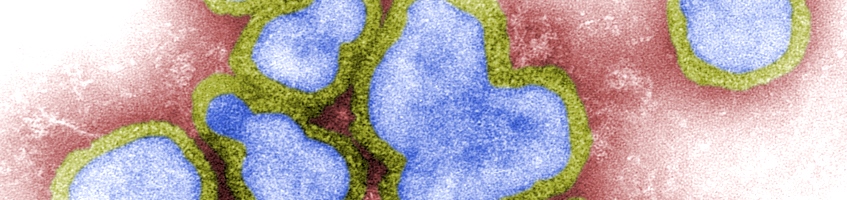 Influenza A (CDC/ F. A. Murphy)